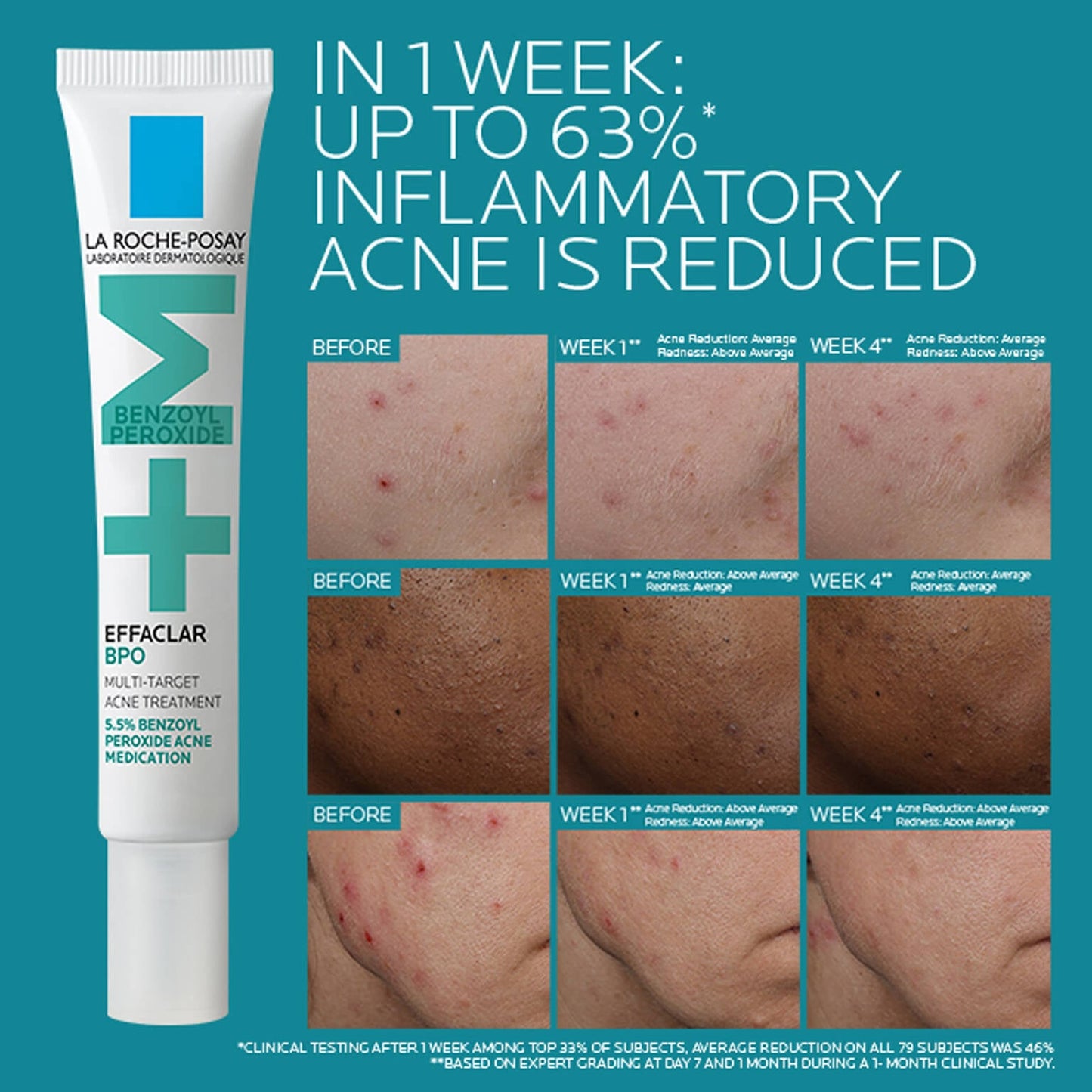 effaclar-bpo-multi-target-acne-treatment-with-5-5-benzoyl-peroxide-j7 EffaclarBPO-ClinicalBA-ATF-1500x1500-2.jpg