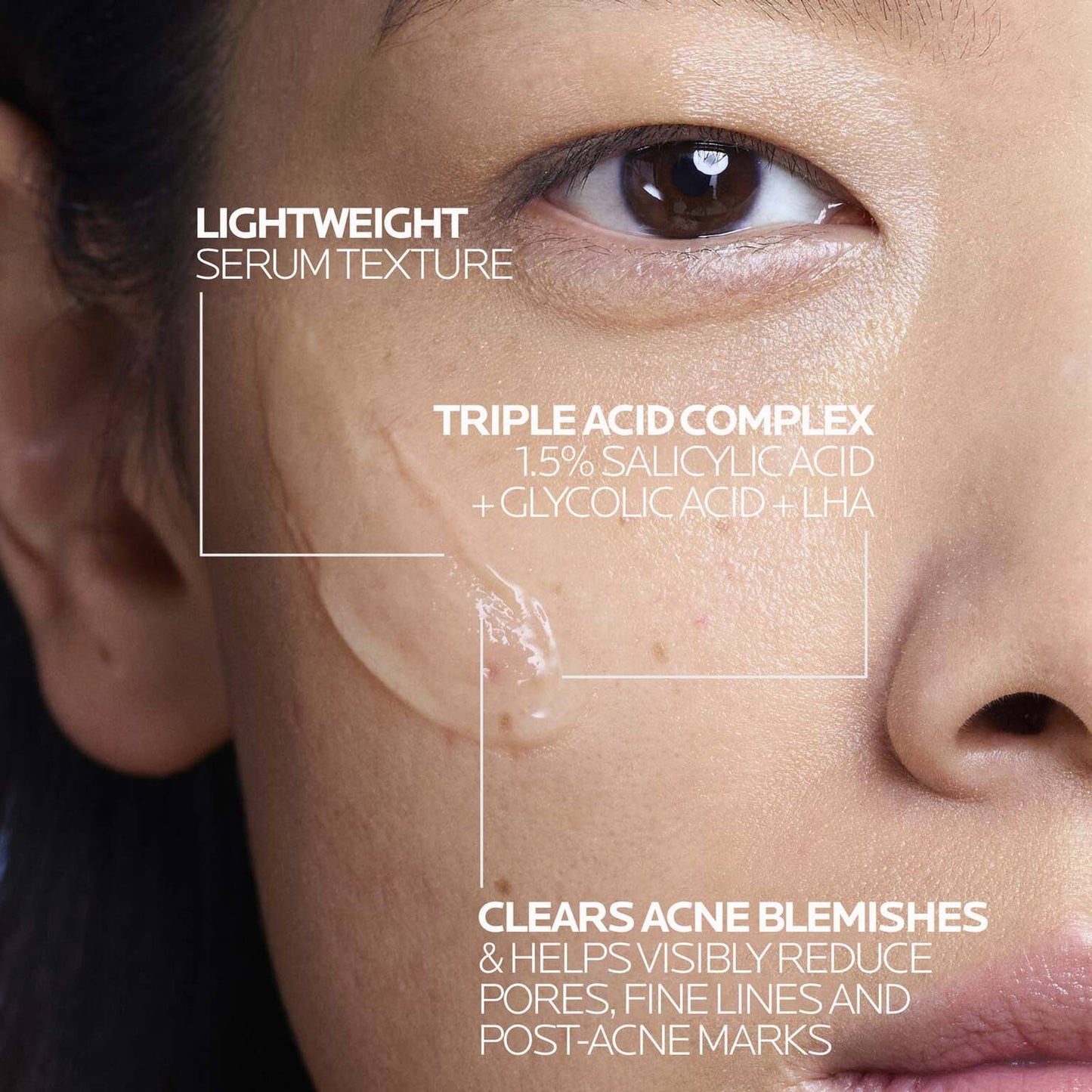 effaclar-salicylic-acid-acne-treatment-serum-g1 LaRochePosay-Product-Effaclar-Effaclar-Serum-30ml-3337875722827-Texture-REV.jpg