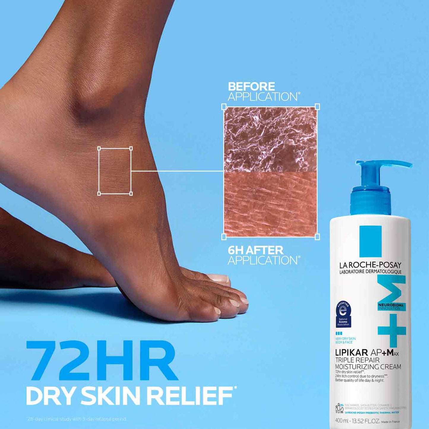 lipikar-ap-max-triple-repair-moisturizing-cream-o3 LaRochePosay-Product-Skincare-Lipikar-Balm-AP+MAX-400ml-3337875941150-ATF-PIM-BeforeAfter.jpg