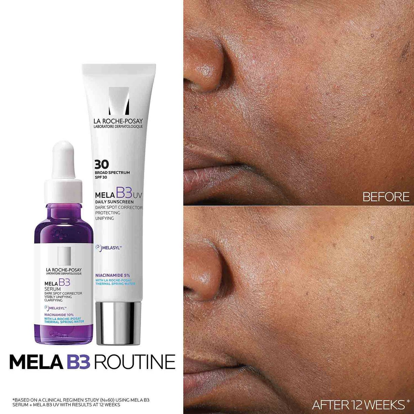 mela-b3-dark-spot-serum-with-melasyltm-niacinamide-w5 Mela-B3-routine_1500X1500.jpg