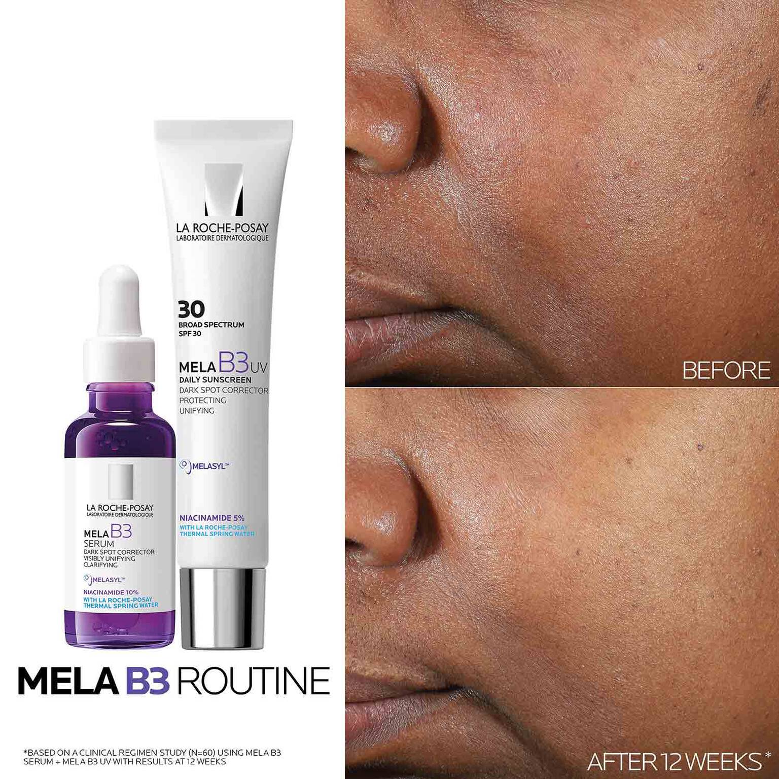mela-b3-dark-spot-serum-with-melasyltm-niacinamide-w5 Mela-B3-routine_1500X1500.jpg