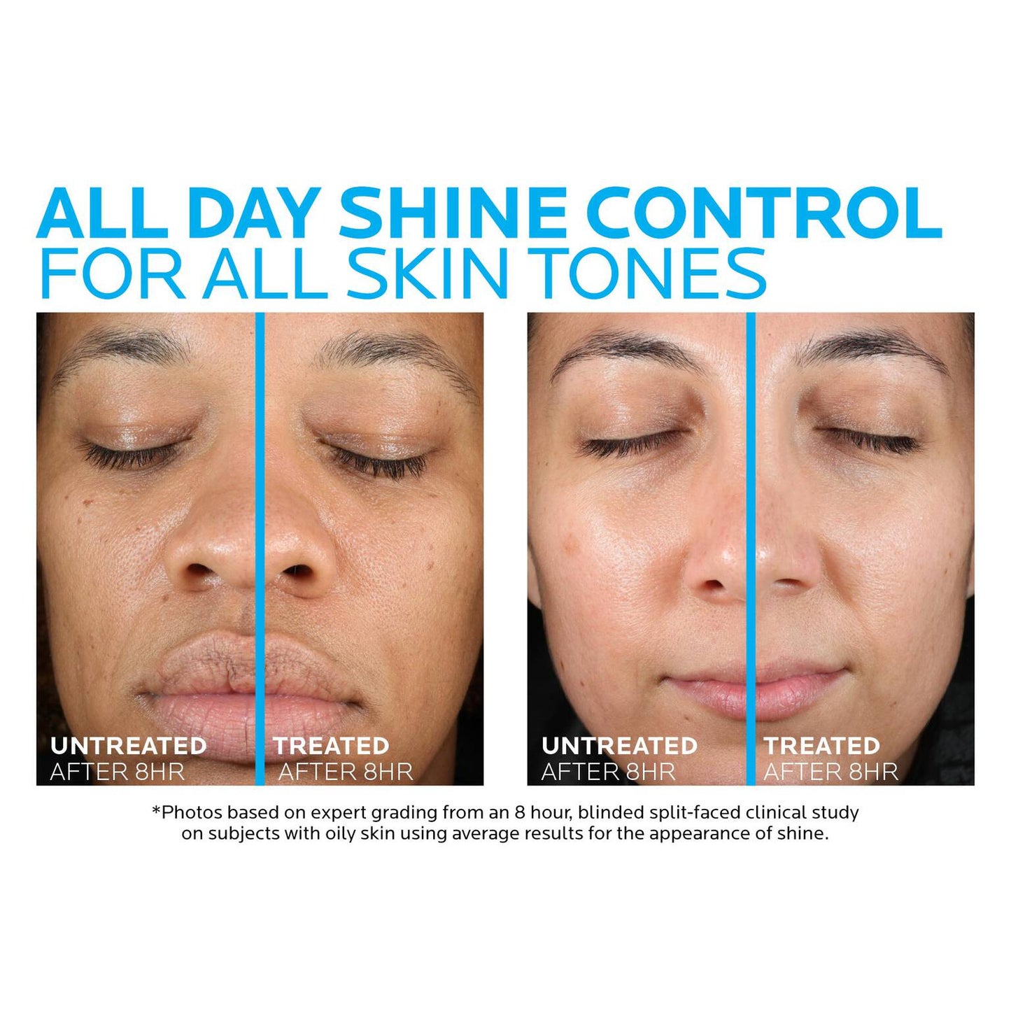 toleriane-double-repair-matte-face-moisturizer-for-oily-skin-a9 la-roche-posay-toleriane-matte-moisturizer-before-and-after-pdp-alt.jpg
